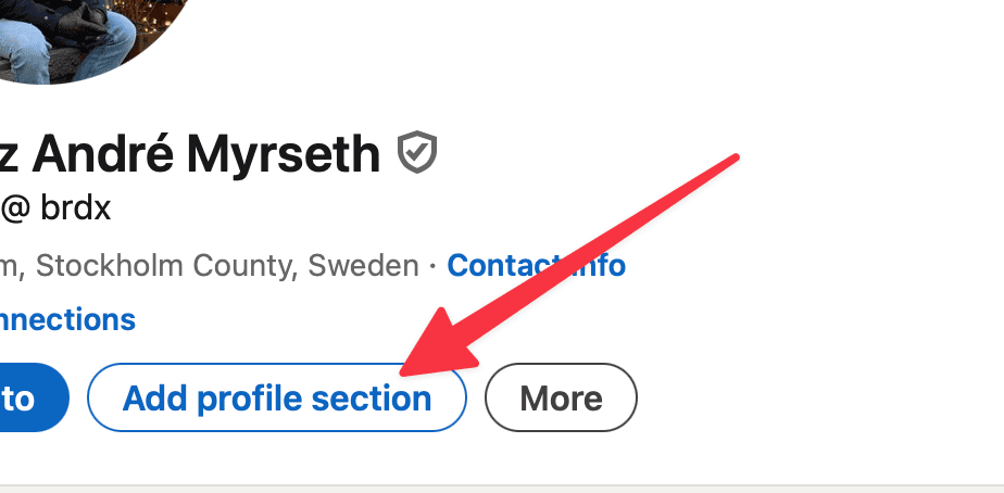 add profile section linkedin